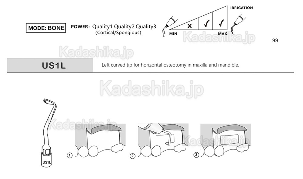 歯科ピエゾサージェリーチップ US1 US1L US1R US2 US3 US4 US5 US6 US7 US11 US12 (Mectron Woodpeckerに適用)